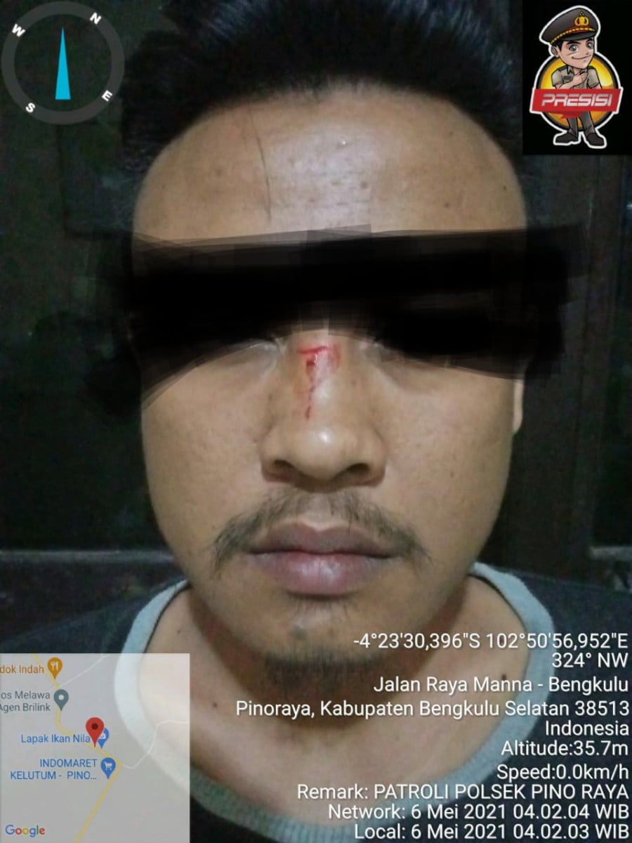 Warga Pino Raya Lapor Polisi, Jadi Korban Penganiayaan