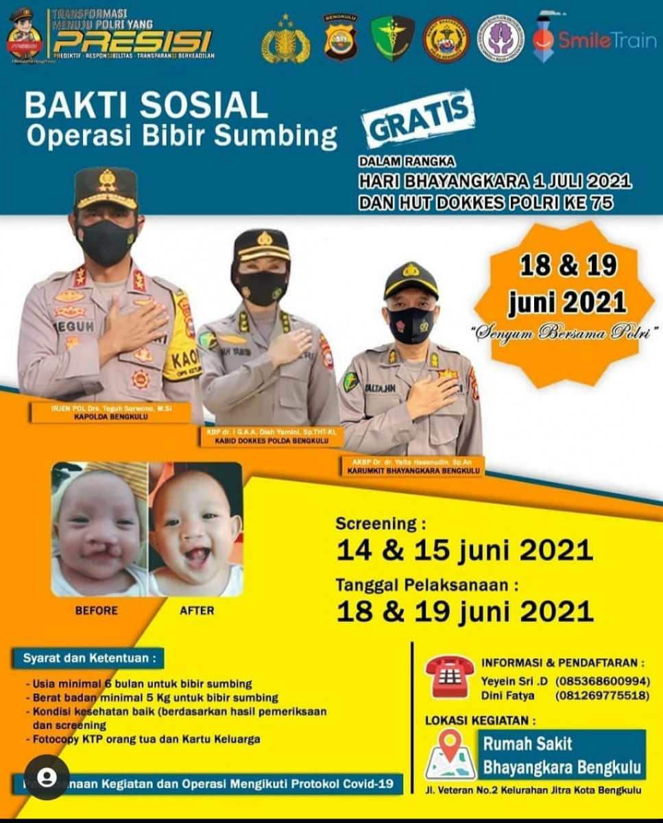 Biddokkes Polda Bengkulu Gelar Operasi Bibir Sumbing Gratis Peringati HUT Bhayangkara dan Dokkes Ke-75