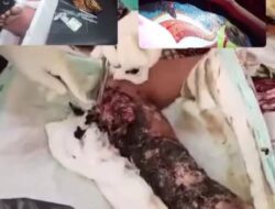 Gadis 12 Tahun Ini Butuh Bantuan Biaya Operasi