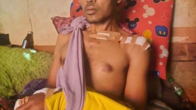 Jadi Korban Penganiayaan, Warga Sembayat Butuh Bantuan Berobat