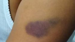 13 Siswa Diduga Aniaya 3 Bocah SD di Rejang Lebong