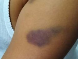 13 Siswa Diduga Aniaya 3 Bocah SD di Rejang Lebong