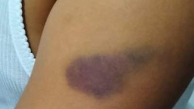 Perundungan siswa sekolah dasar di rejang lebong yang melibatkan beberapa pelaku