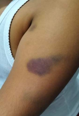 Perundungan siswa sekolah dasar di rejang lebong yang melibatkan beberapa pelaku